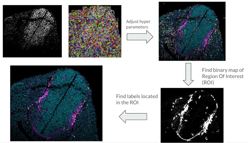 Display of initial brain scan, adjusting hyper parameters, finding binary map of the region of interest, and finally finding labels located in the region of interest